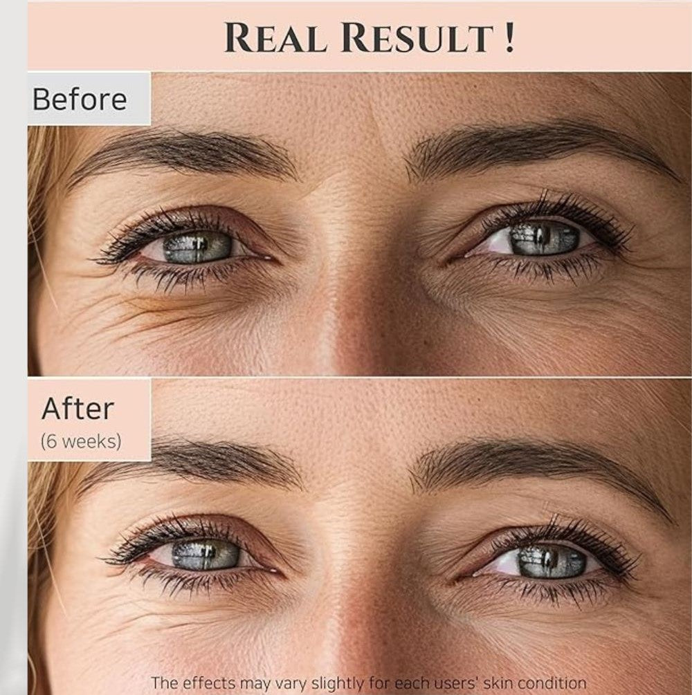 Beauty of Joseon – Revive Eye Serum: Ginseng + Retinal