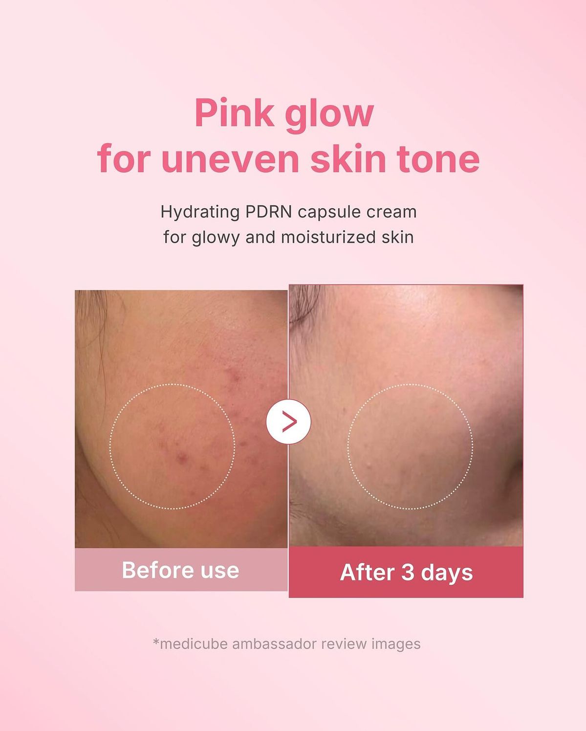 Medicube PDRN Pink Collagen Capsule Cream | Firming & Brightening Moisturizer with Collagen Capsules