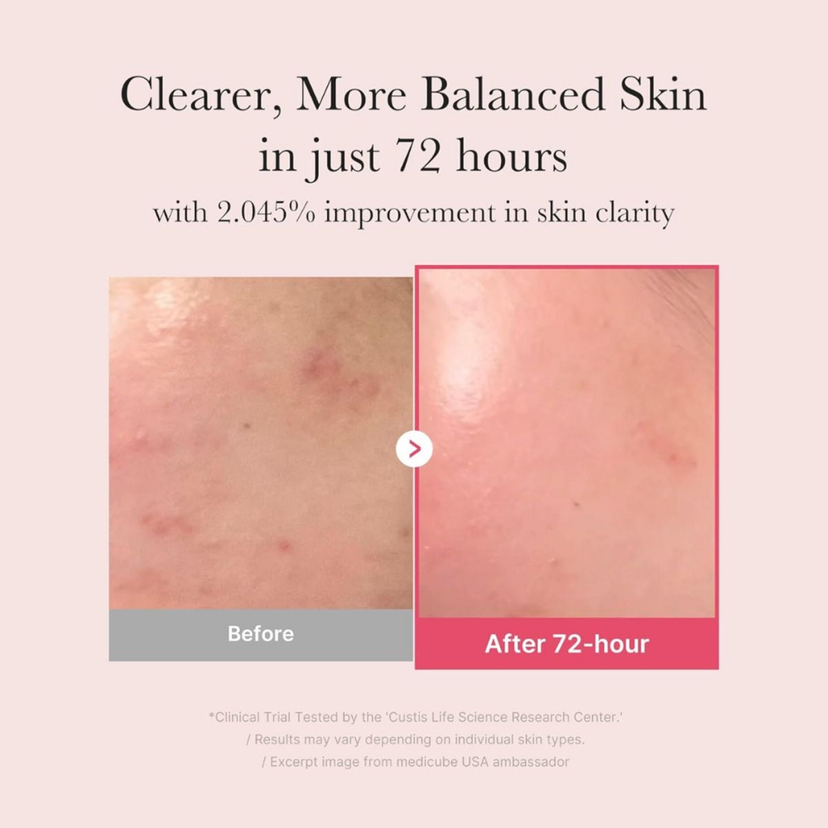 medicube - TXA Niacinamide 15 Serum