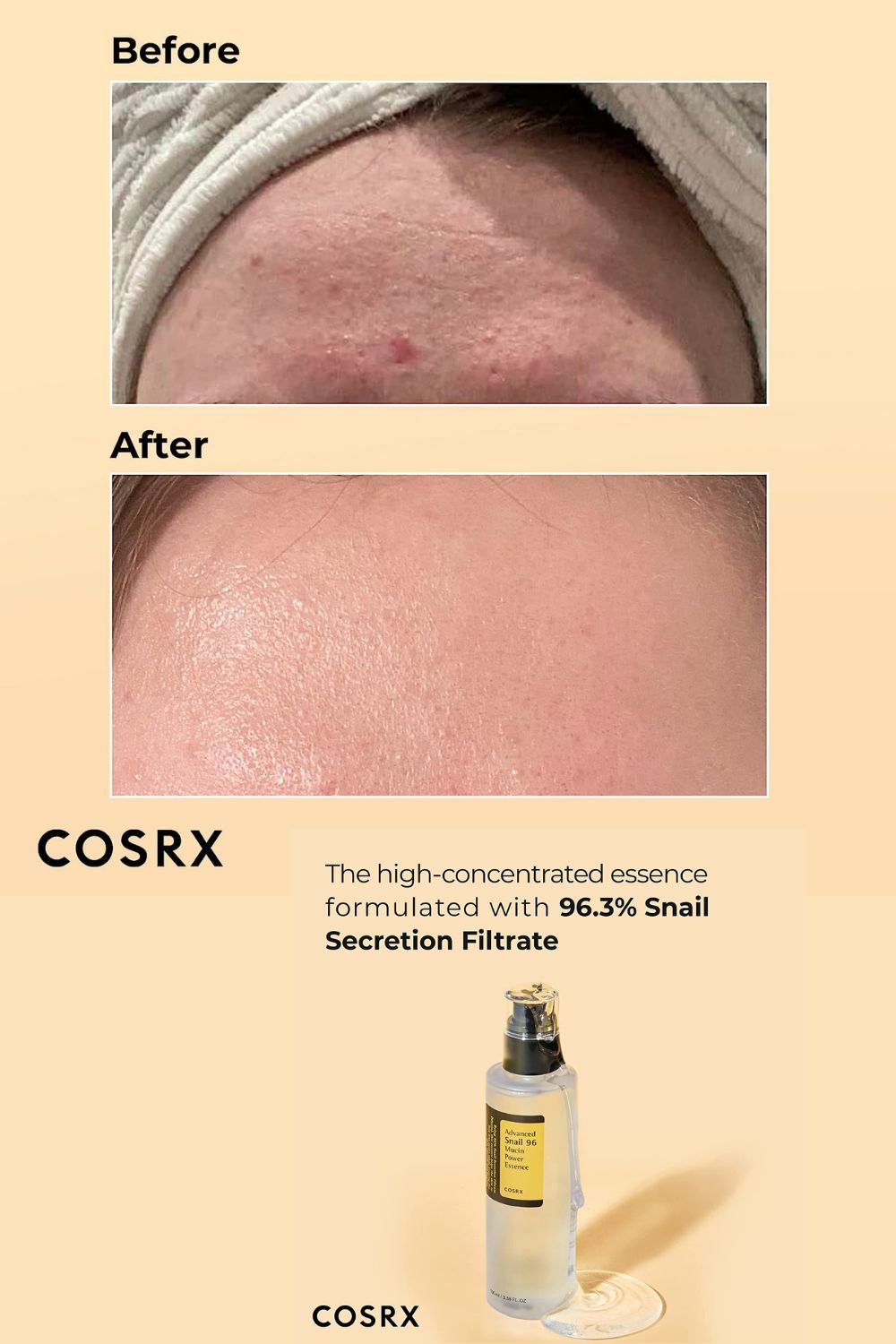 COSRX – Advanced Snail 96 Mucin Power Essence