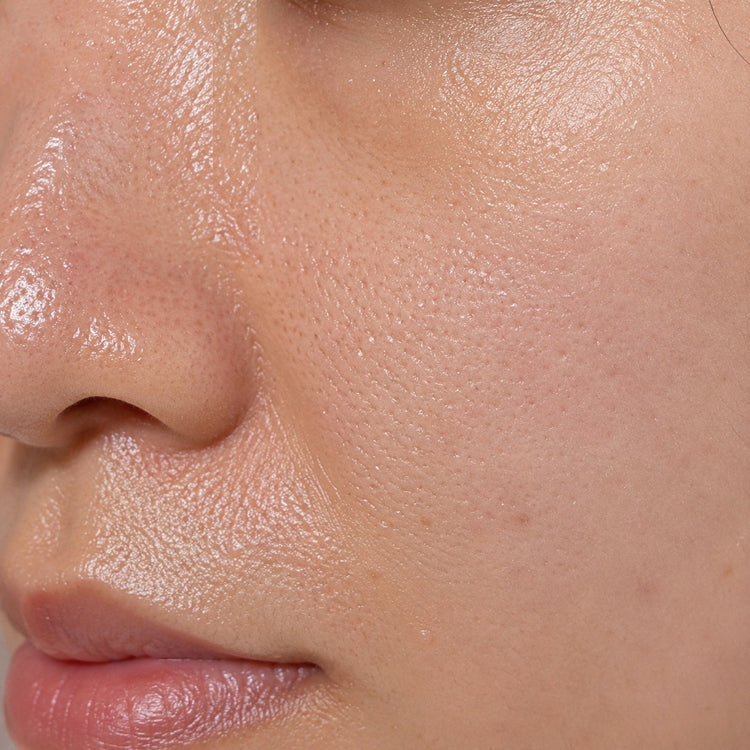 Oily & Combination Skin