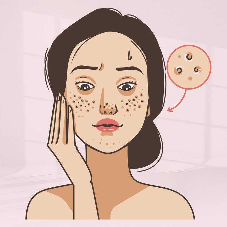 Pore Care