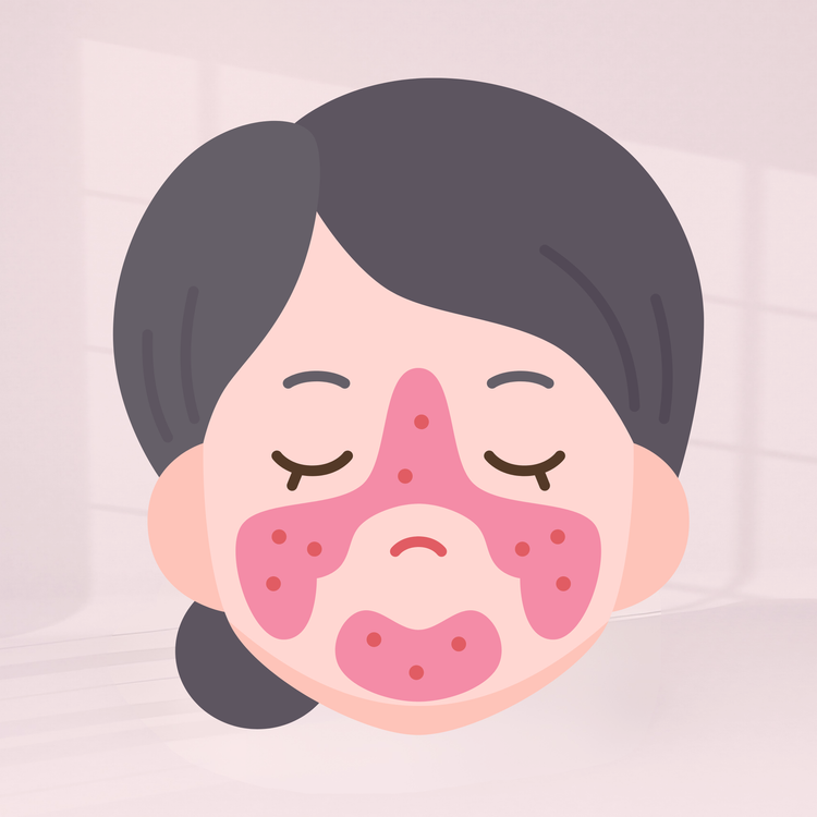 Redness & Rosacea