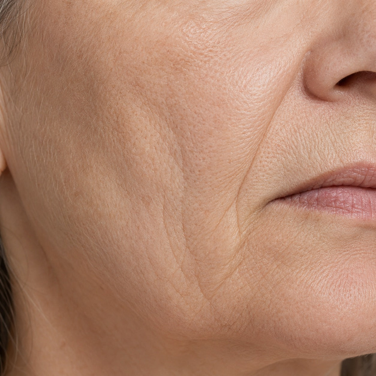 Anti-Aging