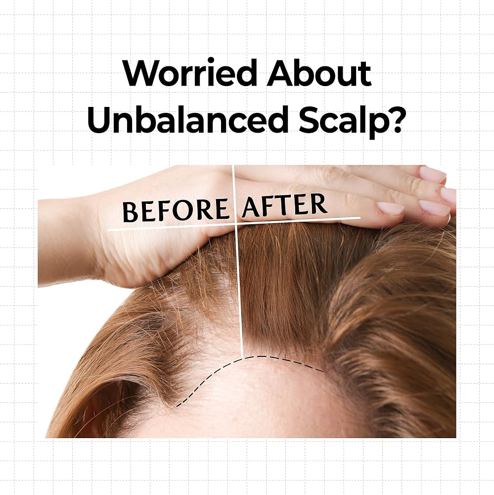 KUNDAL 10X Caffeine Strengthening Scalp Serum