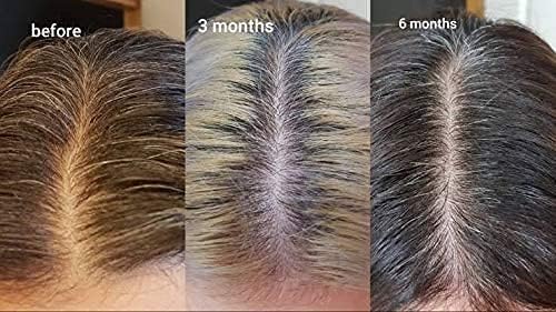 The Ordinary Multi Peptide Serum for Hair Density