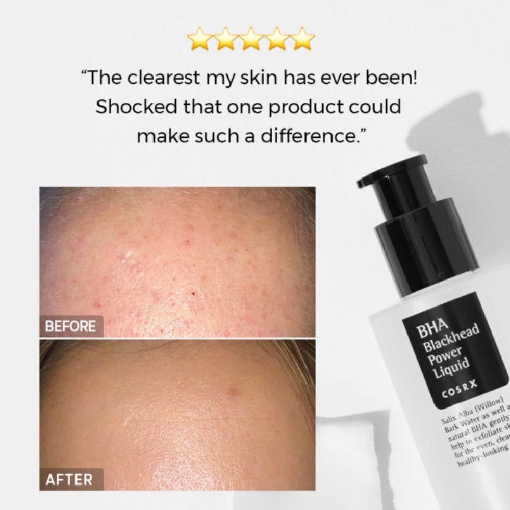 COSRX BHA Blackhead Power Liquid (100ml)