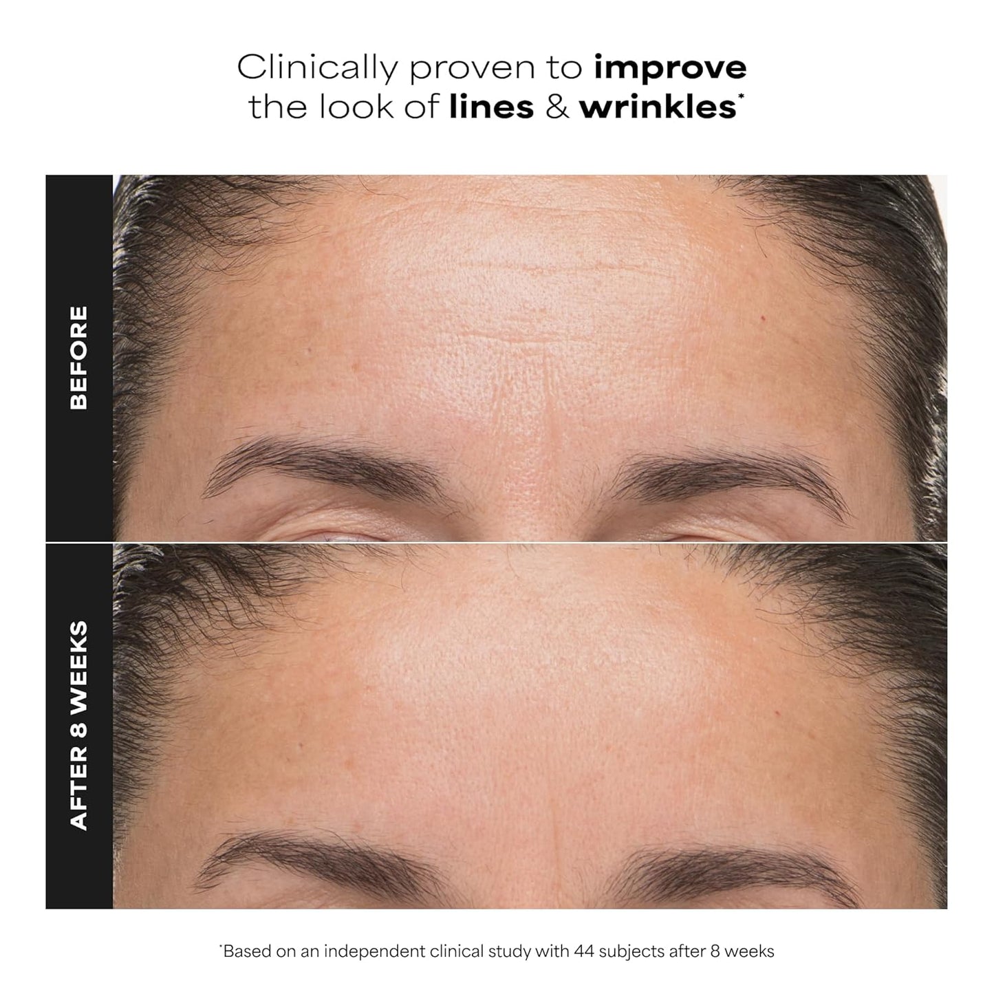 Paula’s Choice 6% Mandelic Acid + 2% Lactic Acid Exfoliant
