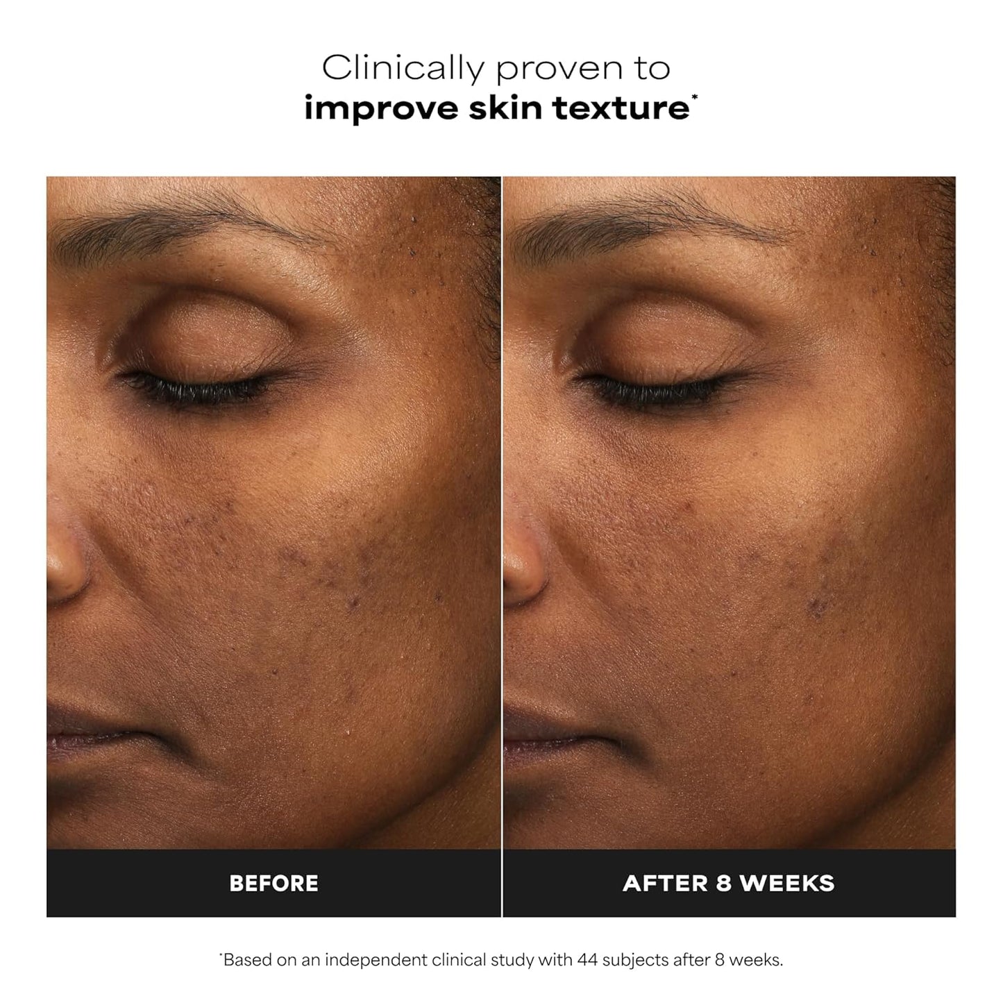 Paula’s Choice 6% Mandelic Acid + 2% Lactic Acid Exfoliant