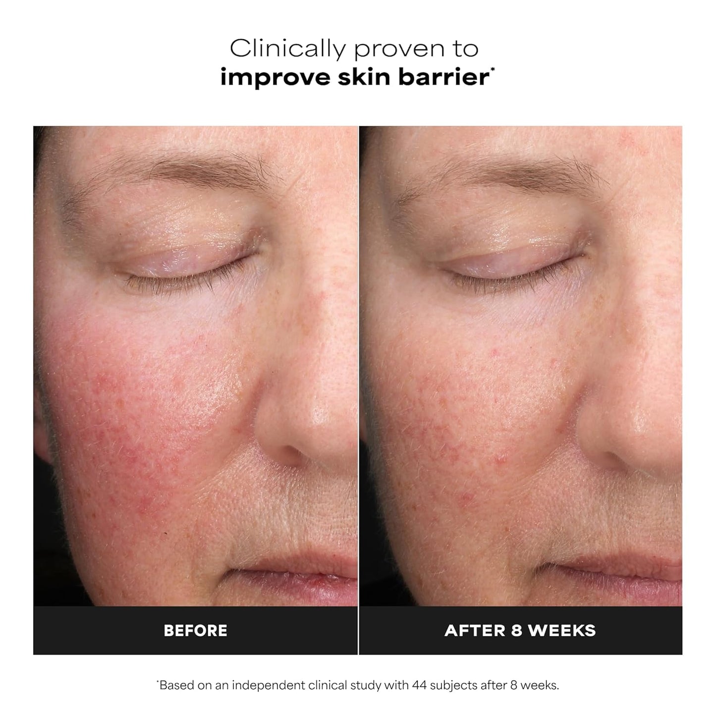 Paula’s Choice 6% Mandelic Acid + 2% Lactic Acid Exfoliant