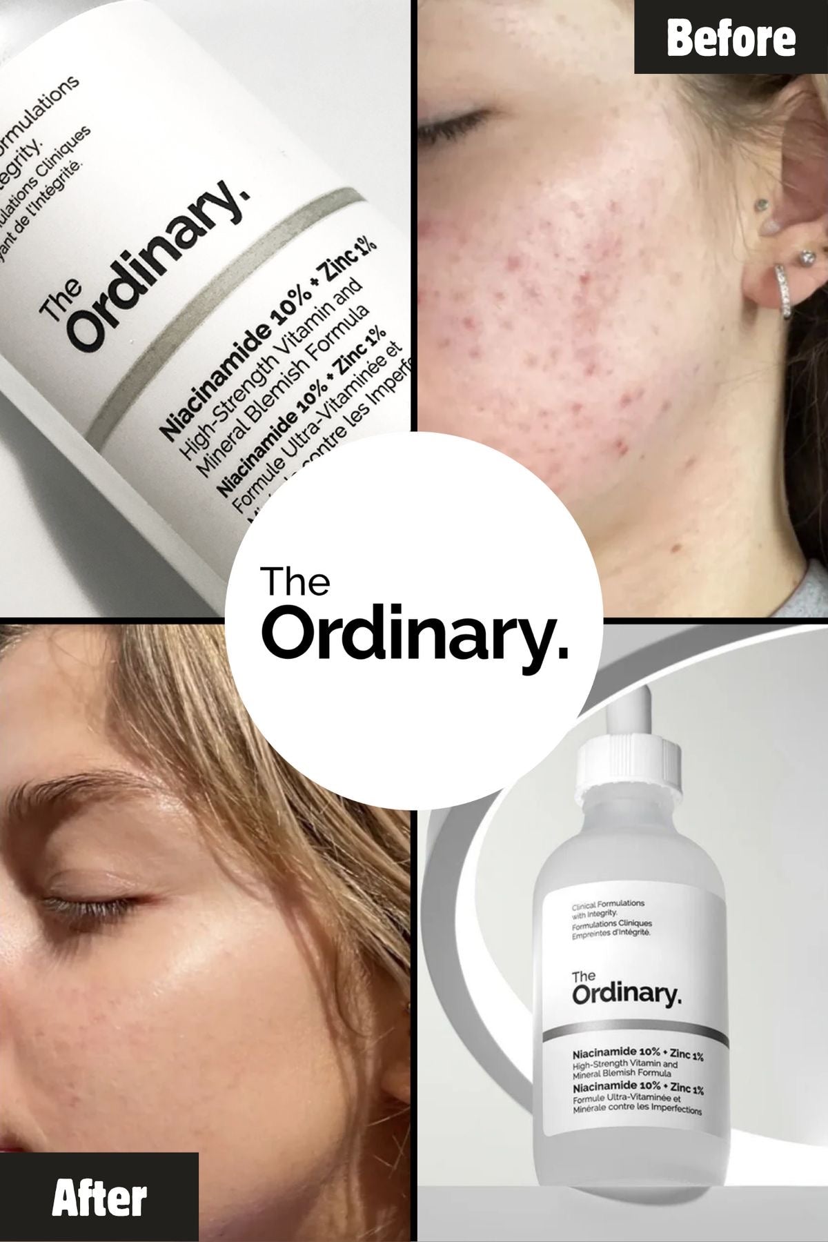 The Ordinary Niacinamide 10% + Zinc 1% – Pore Refining & Oil Control Serum (30ml)