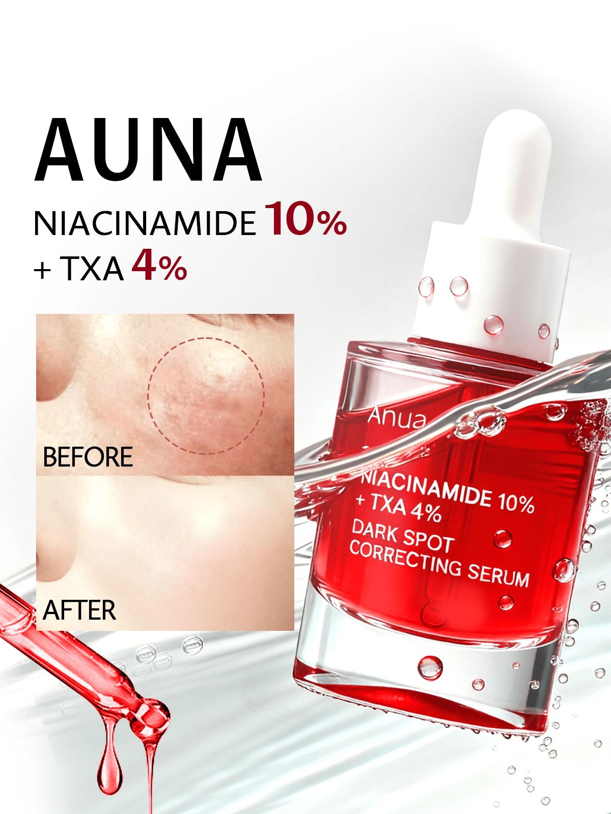 Anua – Niacinamide 10% + TXA 4% Dark Spot Correcting Serum
