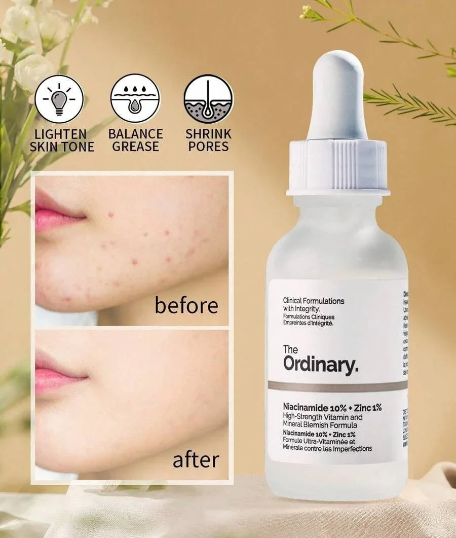 The Ordinary Niacinamide 10% + Zinc 1% serum for clearer skin, pore minimizer, and balanced tone with before/after results