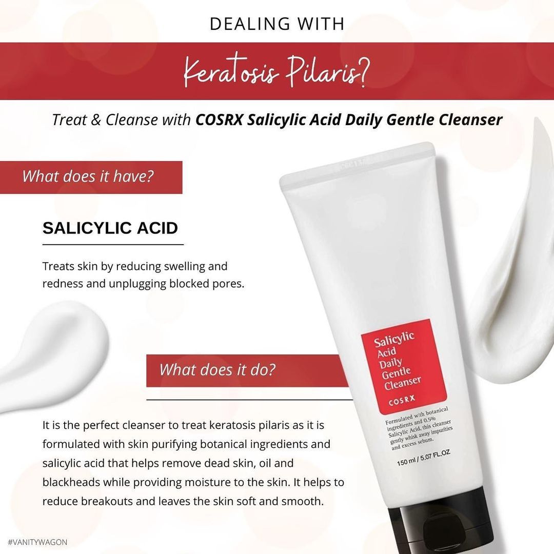 COSRX Salicylic Acid Daily Gentle Cleanser | Acne-Fighting Foaming Cleanser for Oily & Sensitive Skin 50ml