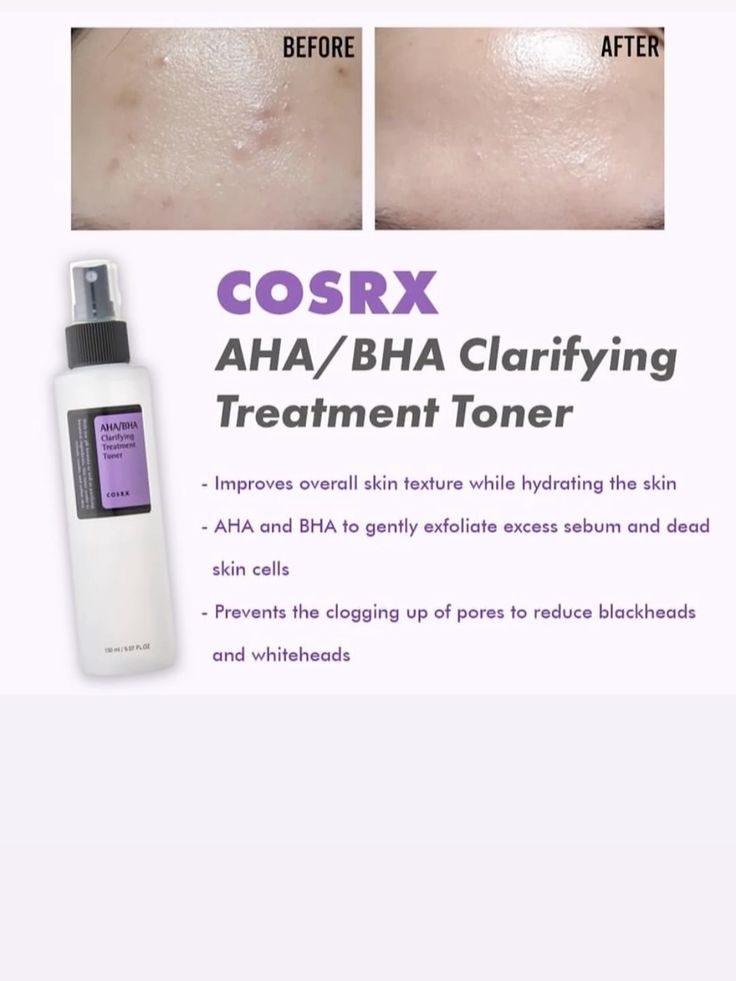 COSRX – AHA/BHA Clarifying Treatment Toner (150ml)